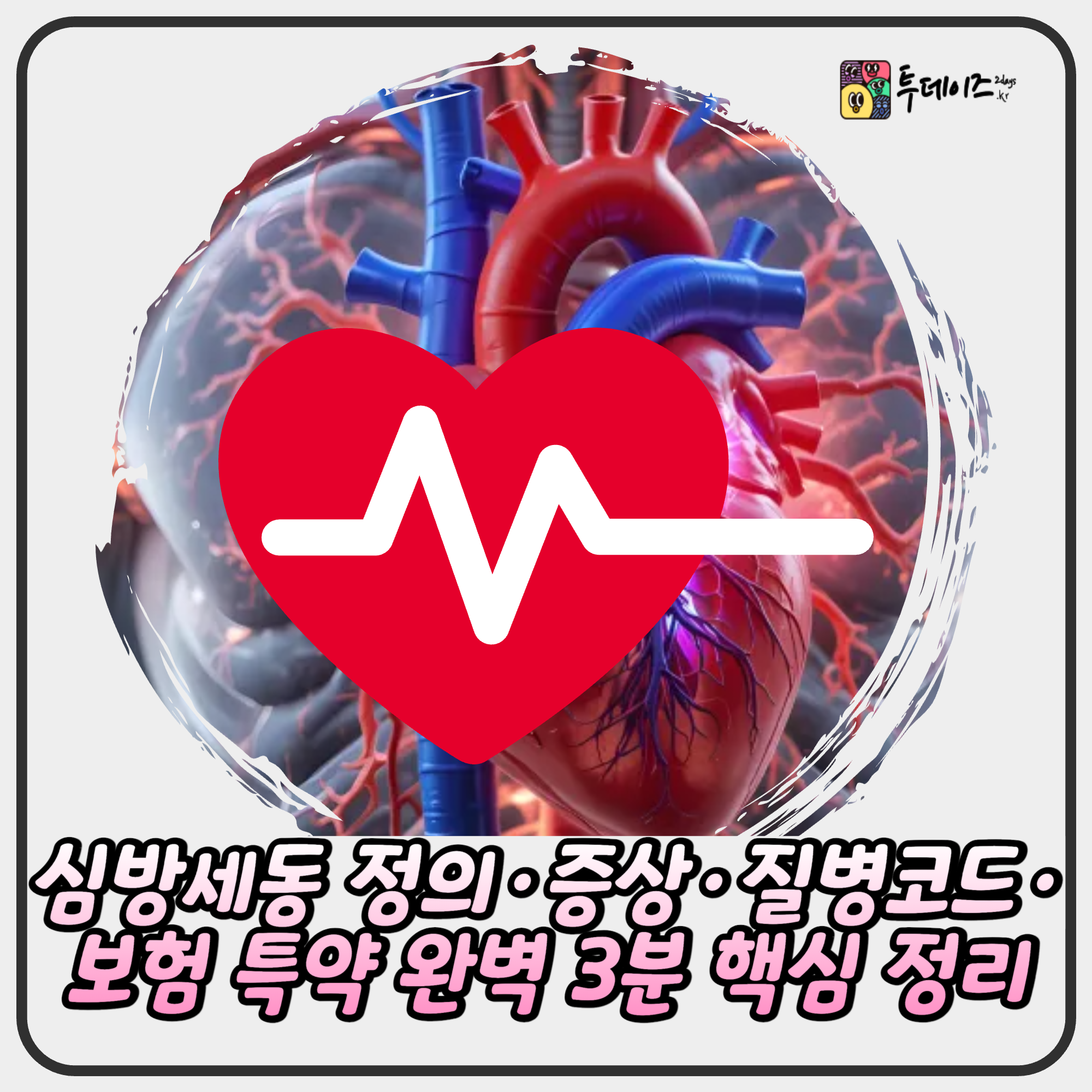 심방세동 정의·증상·질병코드·보험 특약 완벽 3분 핵심 정리